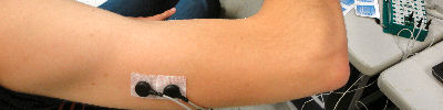 Photo of an electrode on the arm to collect EMG
