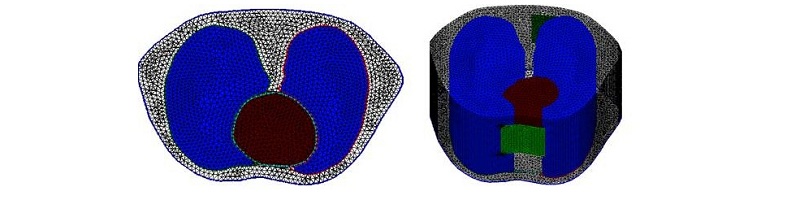 Figure showing Finite Element Method (FEM) mesh of a human thorax